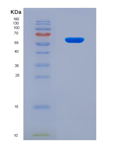 SDS-PAGE analysis of Human CSF2RA (Granulocyte-Macrophage Colony-Stimulating Factor Receptor Subunit Alpha) - Recombinant Protein, showing >95% purity under 15% SDS-PAGE (Reduced)