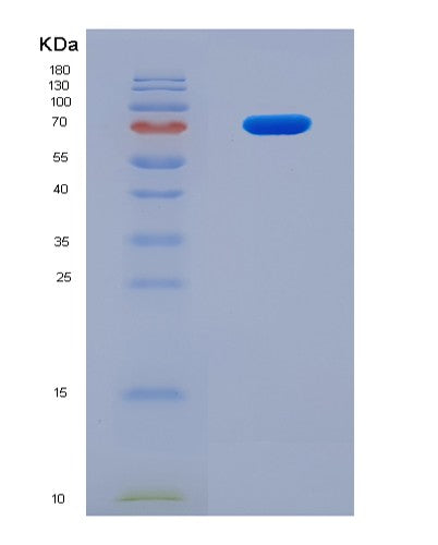 SDS-PAGE analysis of Human BPI (Bactericidal Permeability-Increasing Protein) - Recombinant Protein, showing >90% purity under 15% SDS-PAGE (Reduced)