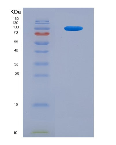 SDS-PAGE analysis of Human C2 (Complement C2) - Recombinant Protein, showing >90% purity under 15% SDS-PAGE (Reduced)