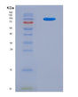 SDS-PAGE analysis of Human C2 (Complement C2) - Recombinant Protein, showing >90% purity under 15% SDS-PAGE (Reduced)
