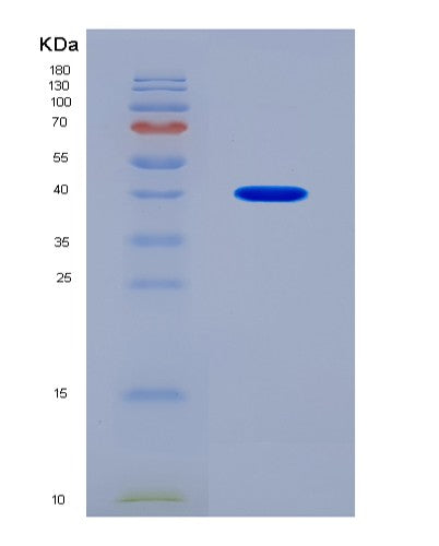 SDS-PAGE analysis of Human GLP1R (Glucagon-Like Peptide 1 Receptor) - Recombinant Protein, showing >90% purity under 15% SDS-PAGE (Reduced)