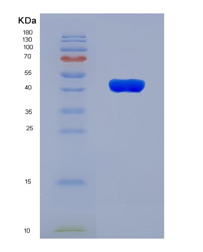 SDS-PAGE analysis of Human TGIF1 (Homeobox Protein Tgif1) - Recombinant Protein, showing >90% purity under 15% SDS-PAGE (Reduced)