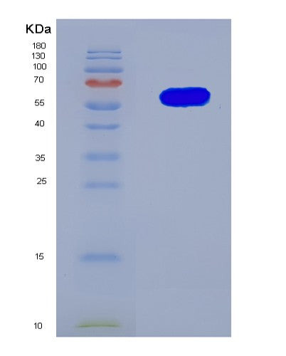 SDS-PAGE analysis of Human PRSS56 (Serine Protease 56) - Recombinant Protein, showing >90% purity under 15% SDS-PAGE (Reduced)