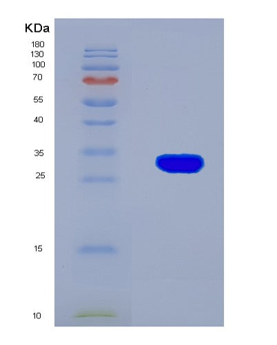 SDS-PAGE analysis of Mouse Serpina7 (Thyroxine-Binding Globulin) - Recombinant Protein, showing >90% purity under 15% SDS-PAGE (Reduced)