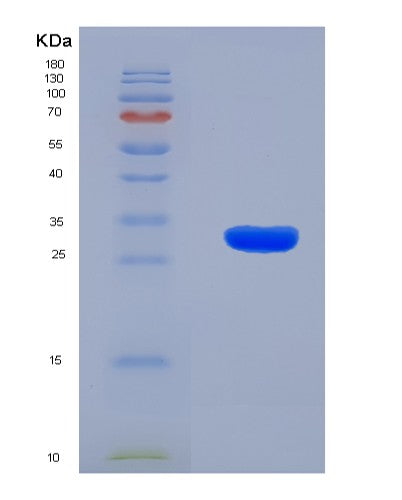 SDS-PAGE analysis of Human PLEC (Plectin) - Recombinant Protein, showing >90% purity under 15% SDS-PAGE (Reduced)