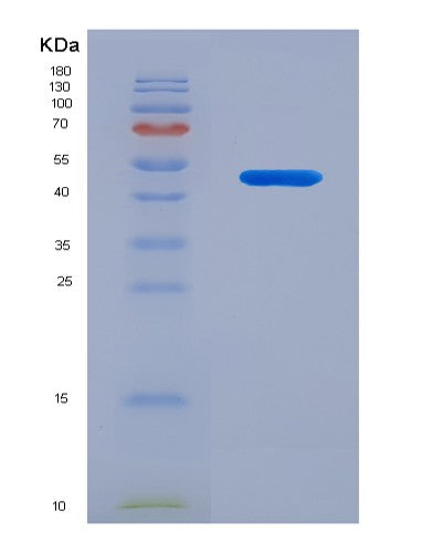 SDS-PAGE analysis of Human LMNA (Prelamin-A/C) - Recombinant Protein, showing >90% purity under 15% SDS-PAGE (Reduced)