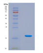 SDS-PAGE analysis of Human NTS (Neurotensin/Neuromedin N) - Recombinant Protein, showing >90% purity under 15% SDS-PAGE (Reduced)