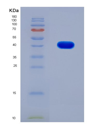 SDS-PAGE analysis of Mouse Anxa2 (Annexin A2) - Recombinant Protein, showing >90% purity under 15% SDS-PAGE (Reduced)