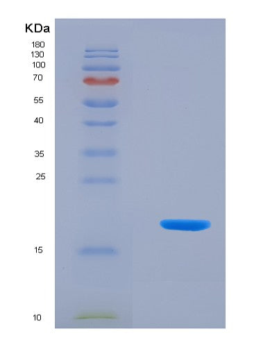 SDS-PAGE analysis of Human KISS1 (Metastasis-Suppressor Kiss-1) - Recombinant Protein, showing >90% purity under 15% SDS-PAGE (Reduced)