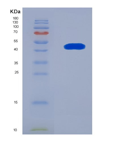 SDS-PAGE analysis of Human TET2 (Methylcytosine Dioxygenase Tet2) - Recombinant Protein, showing >90% purity under 15% SDS-PAGE (Reduced)