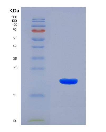 SDS-PAGE analysis of Human TGFB3 (Transforming Growth Factor Beta-3 Proprotein) - Recombinant Protein, showing >90% purity under 15% SDS-PAGE (Reduced)