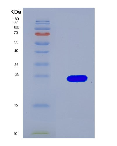 SDS-PAGE analysis of Mouse Igf1r (Insulin-Like Growth Factor 1 Receptor) - Recombinant Protein, showing >90% purity under 15% SDS-PAGE (Reduced)