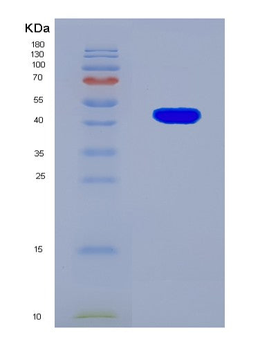 SDS-PAGE analysis of Human OBP2A (Odorant-Binding Protein 2A) - Recombinant Protein, showing >90% purity under 15% SDS-PAGE (Reduced)