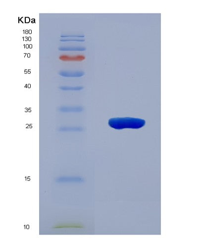SDS-PAGE analysis of Human C1QTNF3 (Complement C1Q Tumor Necrosis Factor-Related Protein 3) - Recombinant Protein, showing >90% purity under 15% SDS-PAGE (Reduced)