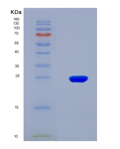 SDS-PAGE analysis of Human CYP26A1 (Cytochrome P450 26A1) - Recombinant Protein, showing >90% purity under 15% SDS-PAGE (Reduced)