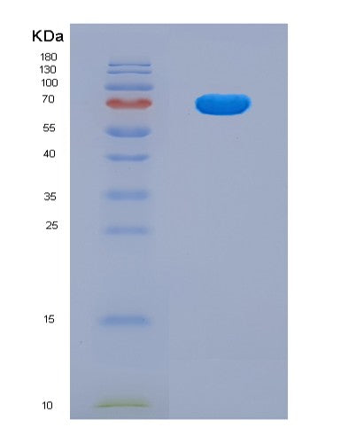 SDS-PAGE analysis of Human UMOD (Uromodulin) - Recombinant Protein, showing >90% purity under 15% SDS-PAGE (Reduced)