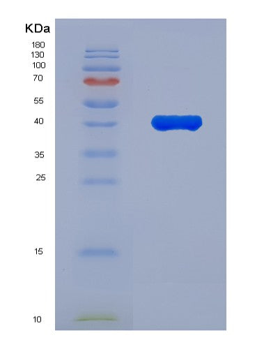 SDS-PAGE analysis of Human DHCR7 (7-Dehydrocholesterol Reductase) - Recombinant Protein, showing >90% purity under 15% SDS-PAGE (Reduced)