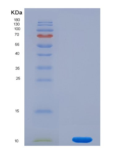 SDS-PAGE analysis of Mouse Cxcl5 (C-X-C Motif Chemokine 5) - Recombinant Protein, showing >90% purity under 15% SDS-PAGE (Reduced)