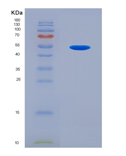 SDS-PAGE analysis of Human TGIF1 (Homeobox Protein Tgif1) - Recombinant Protein, CAT# BLT-08849P showing >90% purity under 15% SDS-PAGE (Reduced)