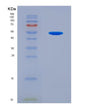 SDS-PAGE analysis of Human TGIF1 (Homeobox Protein Tgif1) - Recombinant Protein, CAT# BLT-08849P showing >90% purity under 15% SDS-PAGE (Reduced)