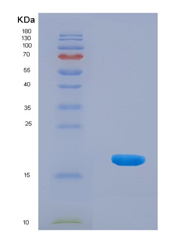 SDS-PAGE analysis of Human CD274 (Programmed Cell Death 1 Ligand 1) - Recombinant Protein, showing >90% purity under 15% SDS-PAGE (Reduced)