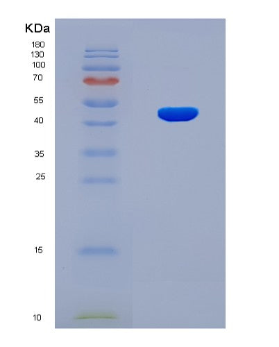 SDS-PAGE analysis of Human FCAR (Immunoglobulin Alpha Fc Receptor) - Recombinant Protein, showing >90% purity under 15% SDS-PAGE (Reduced)