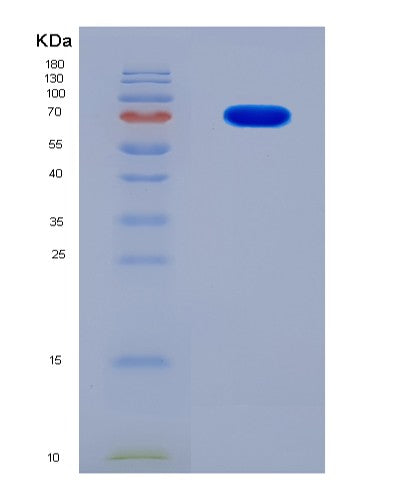 SDS-PAGE analysis of Human MRC2 (C-Type Mannose Receptor 2) - Recombinant Protein, showing >90% purity under 15% SDS-PAGE (Reduced)