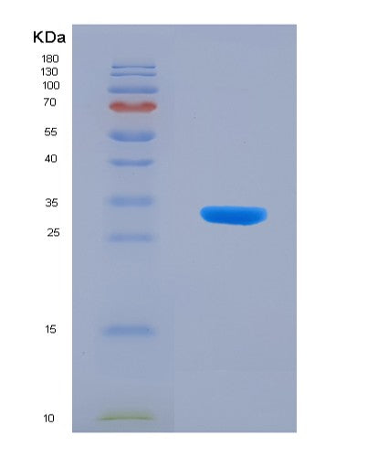 SDS-PAGE analysis of Human SARM1 (Nad(+) Hydrolase Sarm1) - Recombinant Protein, showing >90% purity under 15% SDS-PAGE (Reduced)