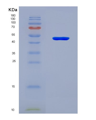SDS-PAGE analysis of Human UBR5 (E3 Ubiquitin-Protein Ligase Ubr5) - Recombinant Protein, showing >90% purity under 15% SDS-PAGE (Reduced)