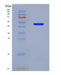 SDS-PAGE analysis of Human UBR5 (E3 Ubiquitin-Protein Ligase Ubr5) - Recombinant Protein, showing >90% purity under 15% SDS-PAGE (Reduced)