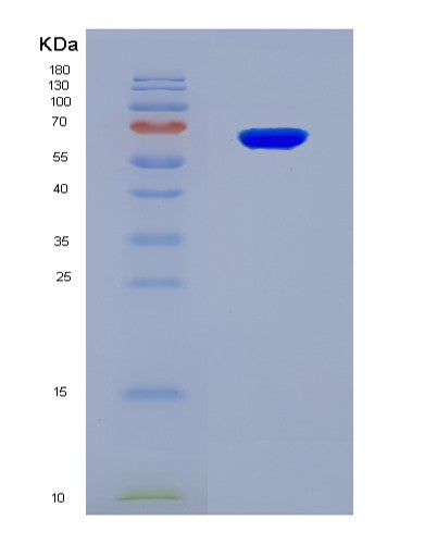 SDS-PAGE analysis of Human ATIC (Bifunctional Purine Biosynthesis Protein Atic) - Recombinant Protein, showing >90% purity under 15% SDS-PAGE (Reduced)