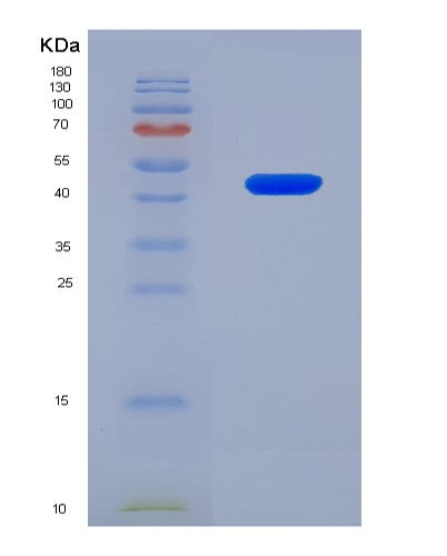 SDS-PAGE analysis of Human LRP1 (Prolow-Density Lipoprotein Receptor-Related Protein 1) - Recombinant Protein, showing >90% purity under 15% SDS-PAGE (Reduced)
