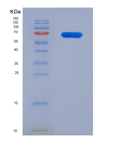 SDS-PAGE analysis of Human ALDH9A1 (4-Trimethylaminobutyraldehyde Dehydrogenase) - Recombinant Protein, showing >90% purity under 15% SDS-PAGE (Reduced)