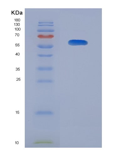SDS-PAGE analysis of Human HLA-A (Hla Class I Histocompatibility Antigen, A Alpha Chain) - Recombinant Protein, showing >90% purity under 15% SDS-PAGE (Reduced)