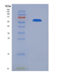 SDS-PAGE analysis of Human HLA-A (Hla Class I Histocompatibility Antigen, A Alpha Chain) - Recombinant Protein, showing >90% purity under 15% SDS-PAGE (Reduced)