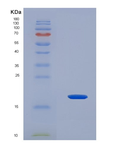 SDS-PAGE analysis of Human RXFP1 (Relaxin Receptor 1) - Recombinant Protein, showing >90% purity under 15% SDS-PAGE (Reduced)