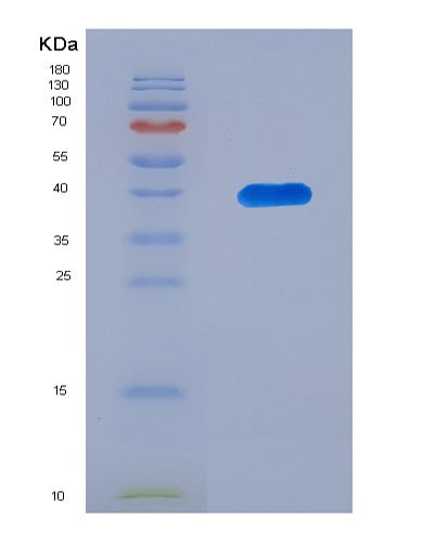 SDS-PAGE analysis of Mouse PEDS1 (Plasmanylethanolamine Desaturase 1) - Recombinant Protein, showing >90% purity under 15% SDS-PAGE (Reduced)