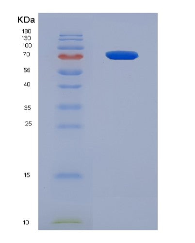 SDS-PAGE analysis of Human ESR1 (Estrogen Receptor) - Recombinant Protein, showing >90% purity under 15% SDS-PAGE (Reduced)