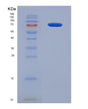 SDS-PAGE analysis of Human ESR1 (Estrogen Receptor) - Recombinant Protein, showing >90% purity under 15% SDS-PAGE (Reduced)