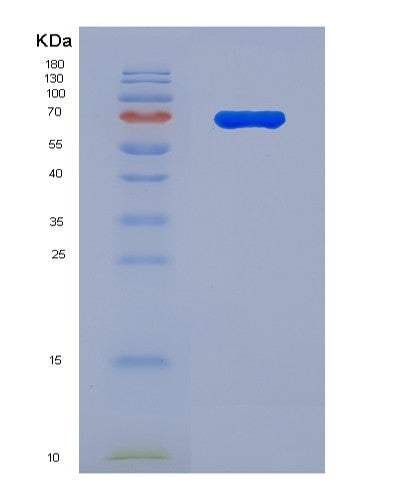 SDS-PAGE analysis of Human ESR2 (Estrogen Receptor Beta) - Recombinant Protein, showing >90% purity under 15% SDS-PAGE (Reduced)