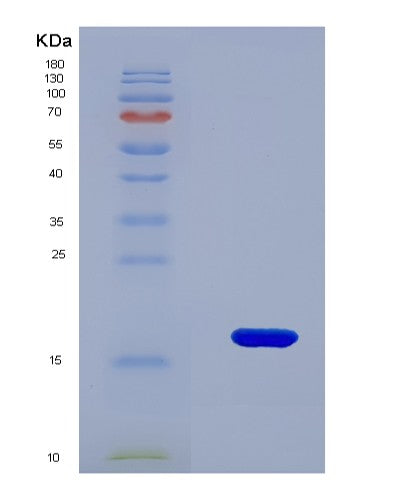 SDS-PAGE analysis of Human BRD4 (Bromodomain-Containing Protein 4) - Recombinant Protein, showing >90% purity under 15% SDS-PAGE (Reduced)