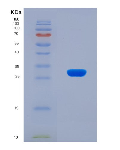 SDS-PAGE analysis of Human AP2B1 (Ap-2 Complex Subunit Beta) - Recombinant Protein, showing >90% purity under 15% SDS-PAGE (Reduced)