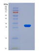 SDS-PAGE analysis of Human AP2B1 (Ap-2 Complex Subunit Beta) - Recombinant Protein, showing >90% purity under 15% SDS-PAGE (Reduced)