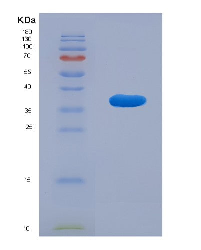 SDS-PAGE analysis of Mouse Sirt6 (Nad-Dependent Protein Deacylase Sirtuin-6) - Recombinant Protein, showing >90% purity under 15% SDS-PAGE (Reduced)