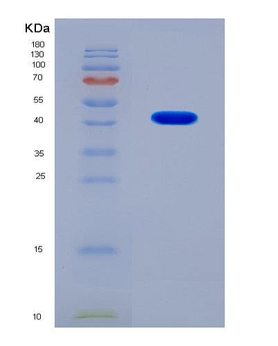 SDS-PAGE analysis of Human NANS (N-Acetylneuraminate-9-Phosphate Synthase) - Recombinant Protein, showing >90% purity under 15% SDS-PAGE (Reduced)