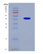 SDS-PAGE analysis of Human NANS (N-Acetylneuraminate-9-Phosphate Synthase) - Recombinant Protein, showing >90% purity under 15% SDS-PAGE (Reduced)