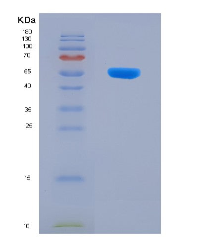 SDS-PAGE analysis of Human CTRC (Chymotrypsin-C) - Recombinant Protein, showing >90% purity under 15% SDS-PAGE (Reduced)