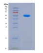 SDS-PAGE analysis of Human CTRC (Chymotrypsin-C) - Recombinant Protein, showing >90% purity under 15% SDS-PAGE (Reduced)
