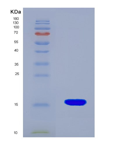 SDS-PAGE analysis of Human NPY1R (Neuropeptide Y Receptor Type 1) - Recombinant Protein, showing >90% purity under 15% SDS-PAGE (Reduced)