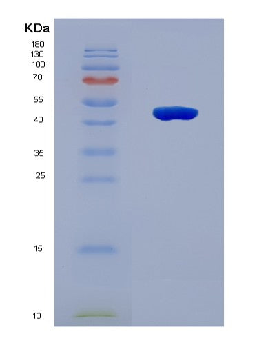 SDS-PAGE analysis of Human BBS5 (Bbsome Complex Member Bbs5) - Recombinant Protein, showing >90% purity under 15% SDS-PAGE (Reduced)